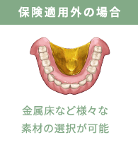 保険適用外の場合：金属床など様々な素材の選択が可能