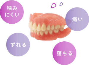 噛みにくい、痛い、ずれる、落ちる