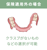 保険適用外の場合：クラスプがないものなどの選択が可能